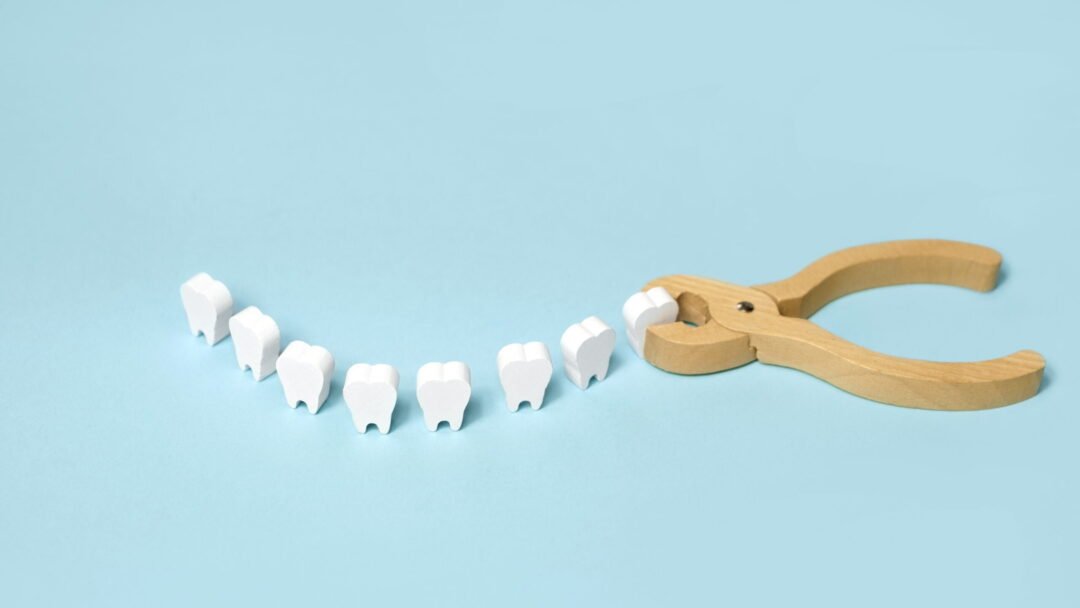 Text is Wisdom Tooth Extraction In Senawang, Seremban.