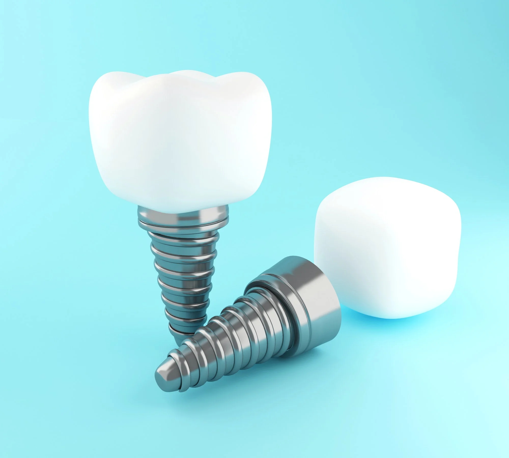 Tooth Implant in Senawang, Seremban