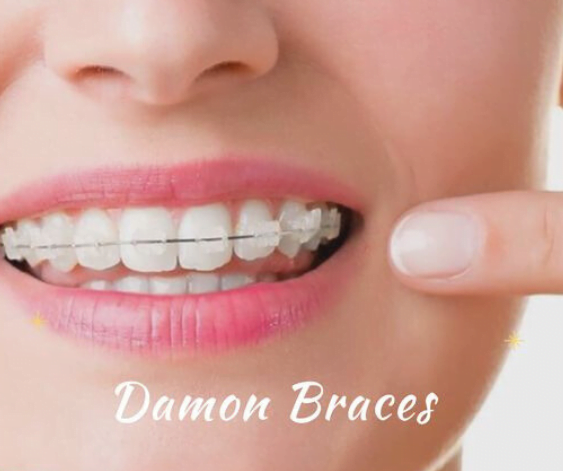 Damon Braces in Senawang, Seremban