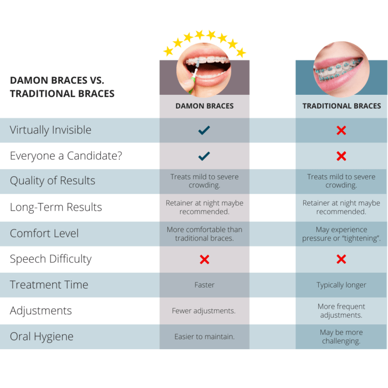 Damon Braces vs. Traditional Braces