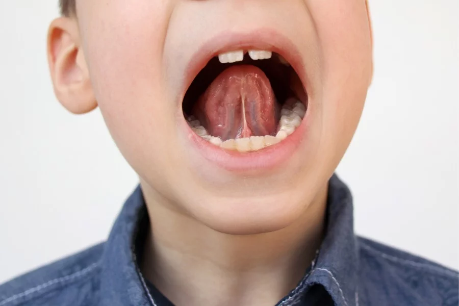 boy kid opened his mouth oral cavity close teeth performs