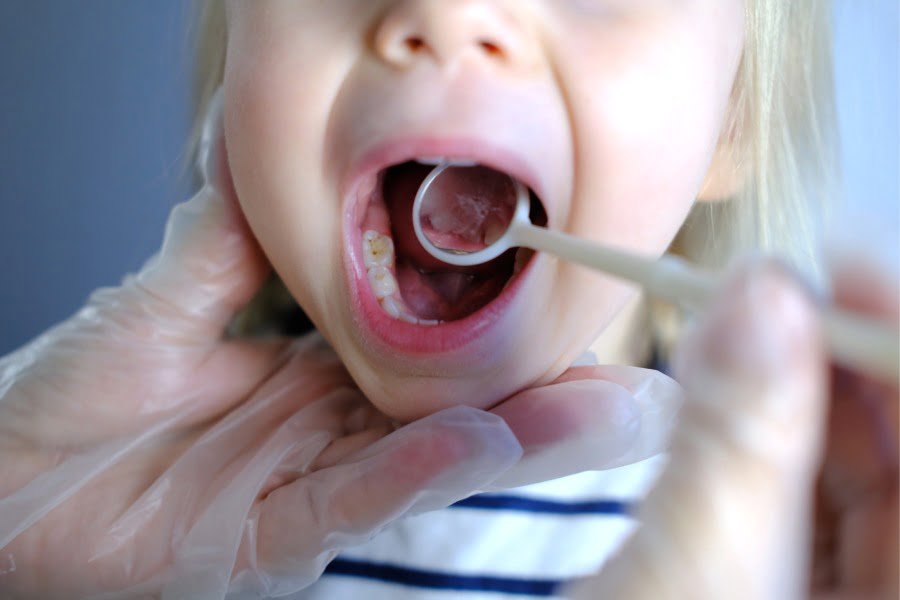 dentist doctor examines oral cavity small patient uses mouth mirror