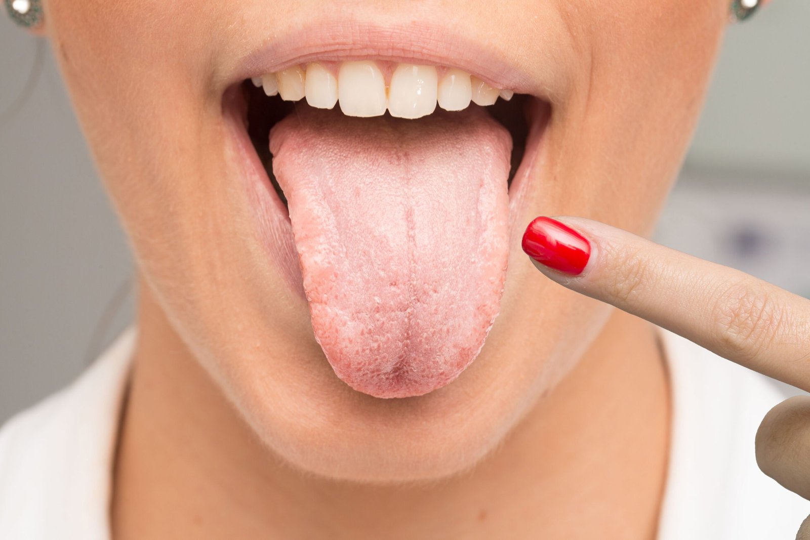 woman having candidiasis pointing her tongue with 2023 11 27 05 13 18 utc scaled