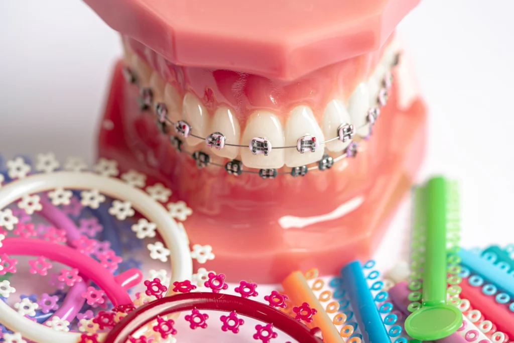 fake braces marketing cozy t
