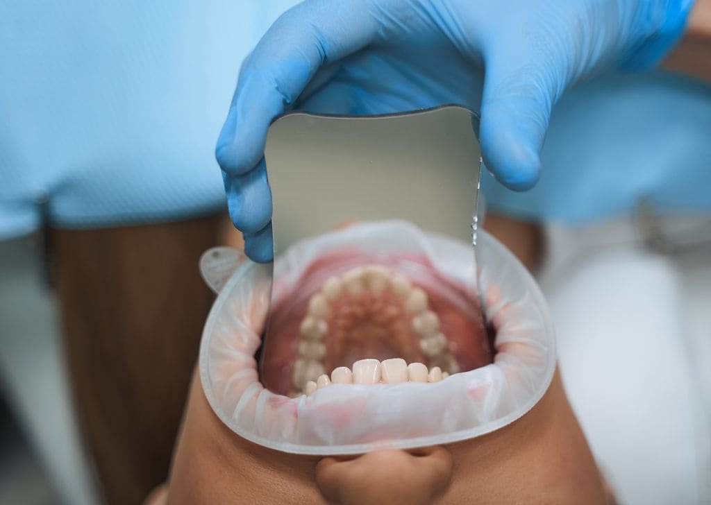 Dental Veneers in Seremban | Natural Smile, Real Results