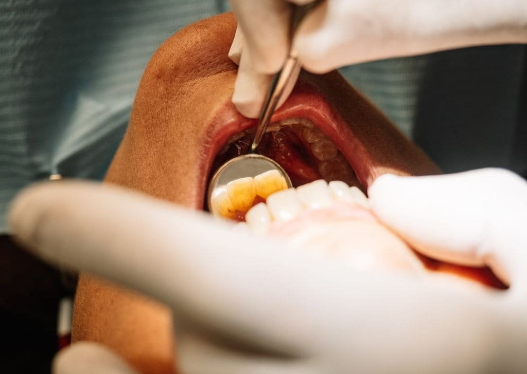 Laser Dentistry Benefits for Gum Disease | Advanced Dental Care 6 Laser Dentistry Benefits for Gum Disease | Advanced Dental Care
