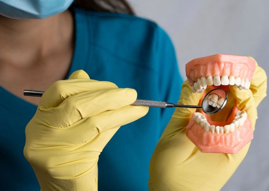 Dentist explaining with a model not all black spots on tooth are cavities. 