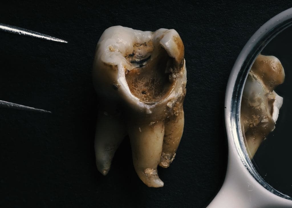 Bad breath is a warning sign a cavity might be forming. 