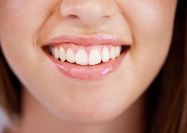 A woman showing her perfectly white teeth.