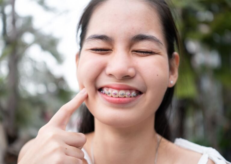 A woman showing the braces fitted on her teeth showing the side effects of getting braces.