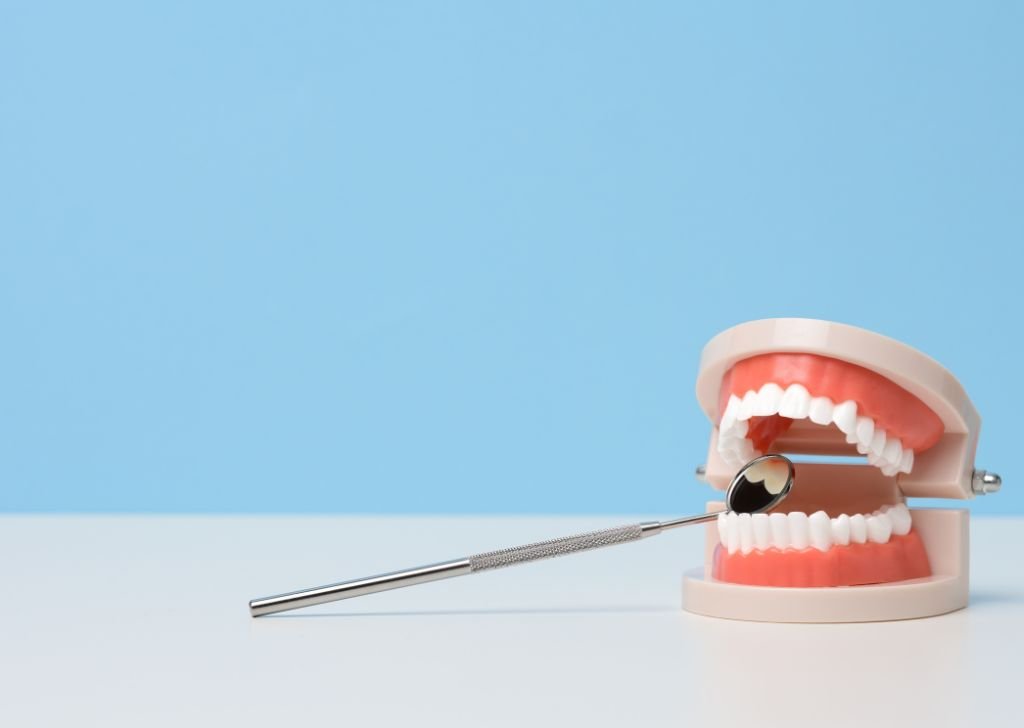 Dental model used by dentists to explain how to whiten teeth naturally.