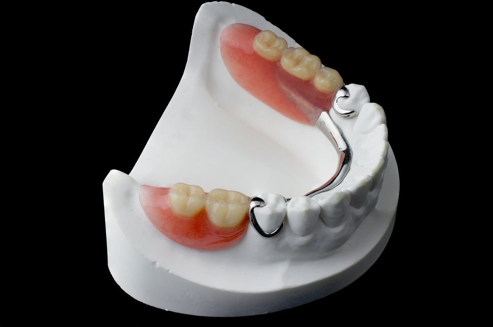 Gigi Palsu Separa (Partial Dentures)
