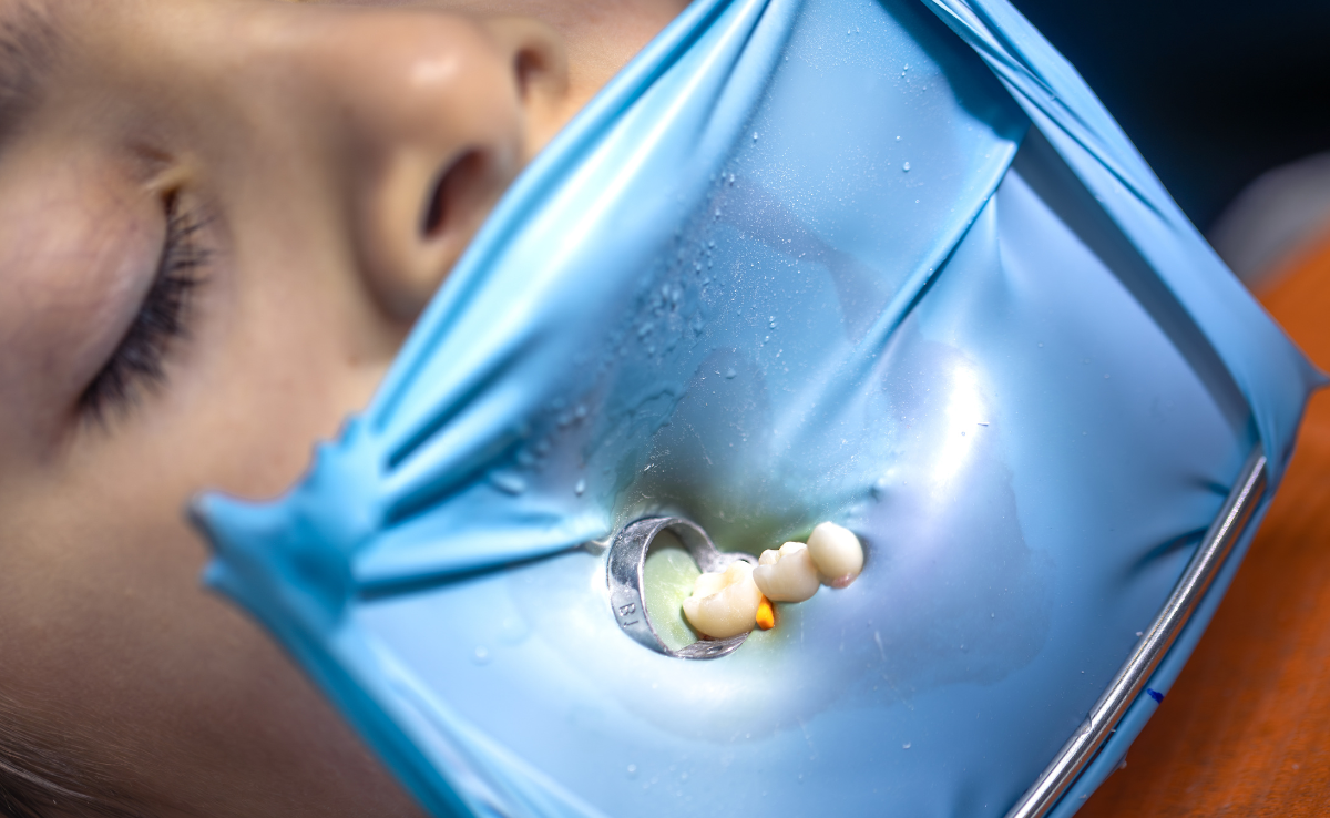 Root Canal Treatment in Senawang, Seremban 29 Tooth Isolation
