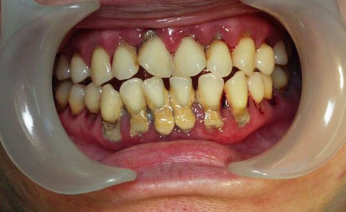 Oral and Maxillofacial Surgery in Seremban 19 5