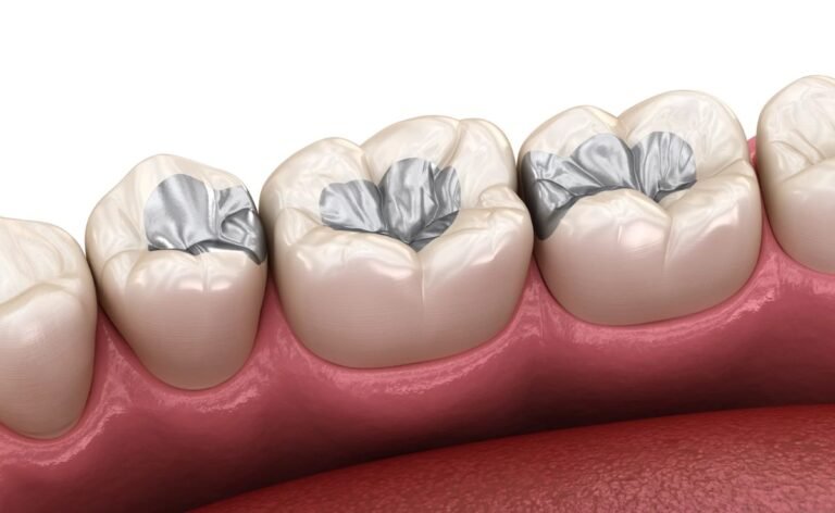 Tooth Filling in Malaysia: When You Need It, Costs & What to Expect