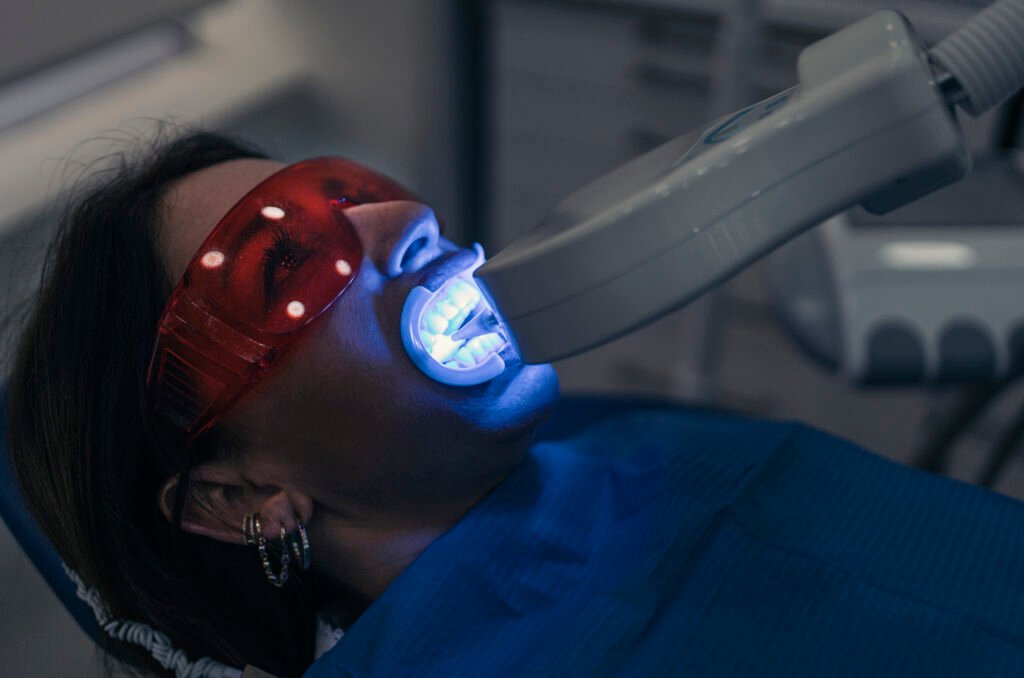 teeth whitening at the klinik