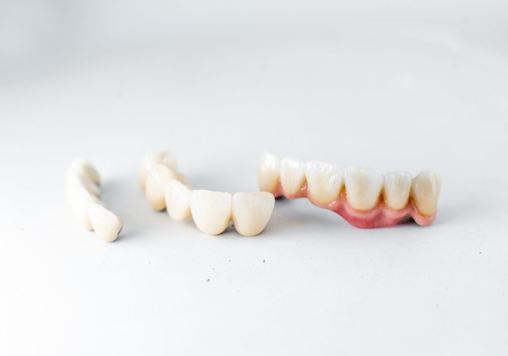 Close-up on dental crowns on the white background. Concept of prosthetics and implantation in dentistry